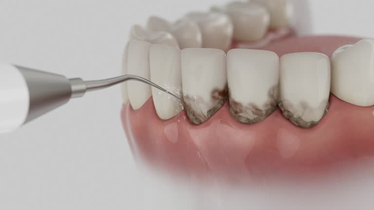 Reliable Dental contractor in Cottleville, MO by Smile Center Dentistry